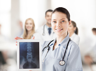 Image showing female doctor with x-ray on tablet pc