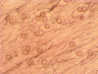 Image showing Trichinella spiralis - parasitic worm microscope