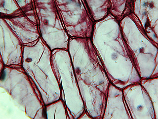 Image showing Onion epidermus micrograph