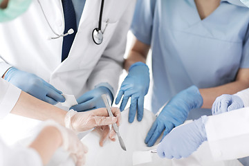 Image showing young group of doctors doing operation