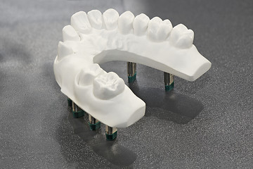 Image showing Plaster model of teeth 