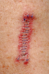 Image showing Stitches
