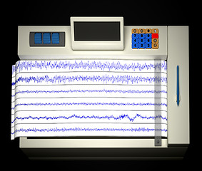 Image showing encephalogram