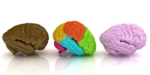 Image showing Human brains