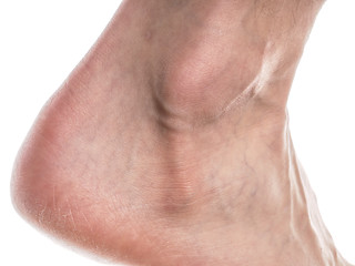 Image showing Male ankle