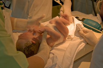 Image showing Newborn resuscitation