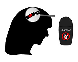 Image showing Head of woman, louse, nit and lice shampoo