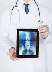 Image showing male doctor holding tablet pc with x-ray