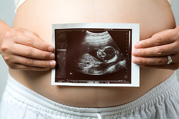 Image showing Pregnant woman