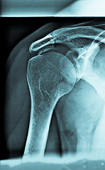 Image showing Xray