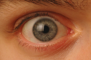 Image showing Close up of wide-eyed eyeball