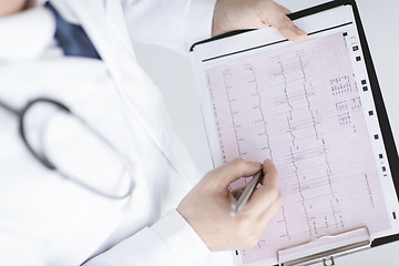 Image showing male doctor hands with cardiogram