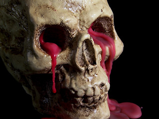 Image showing Bleeding Human Skull