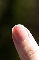 Image showing Bloody thumb