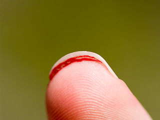 Image showing Bloody thumb