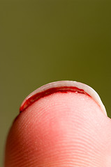 Image showing Bloody thumb