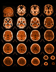 Image showing CT and MRI of the skull