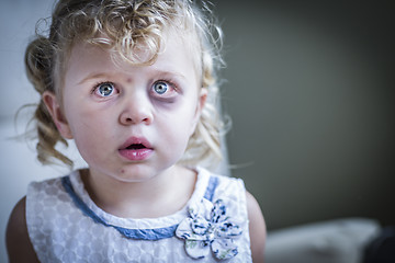 Image showing Sad, Bruised and Frightened Little Girl