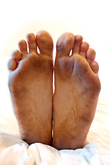 Image showing Dirty Feet