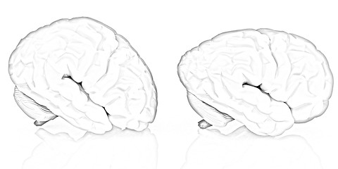 Image showing Human brains