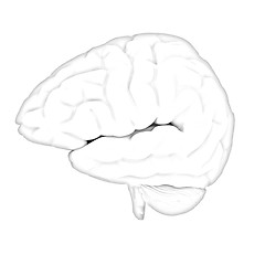 Image showing Human brain