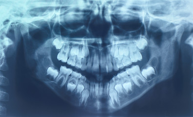 Image showing Glowing and radiant MRI scan