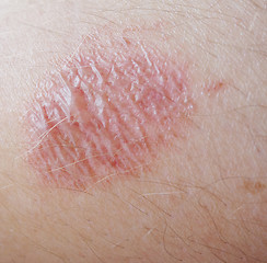 Image showing skin