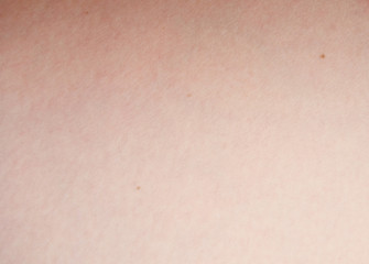 Image showing skin texture