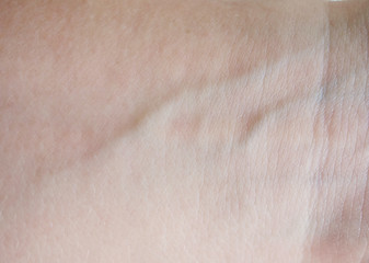 Image showing human skin