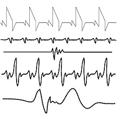 Image showing electrocardiogram