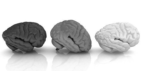 Image showing Human brains