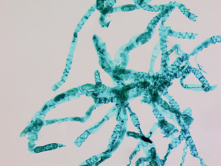 Image showing Spirogyra micrograph