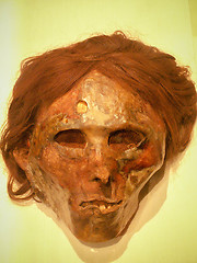 Image showing Preserved Head With Trepanning Hole