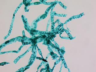 Image showing Spirogyra micrograph