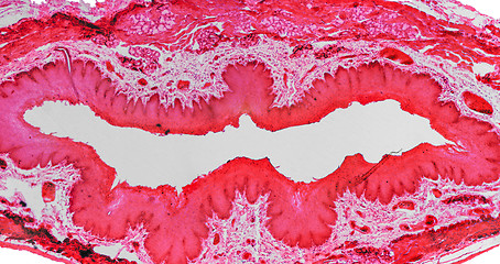 Image showing Epithelium micrograph