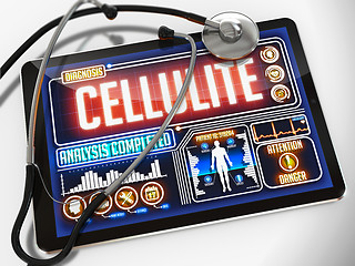 Image showing Cellulite on the Display of Medical Tablet.