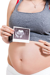 Image showing Pregnant woman displaying a prenatal ultrasound