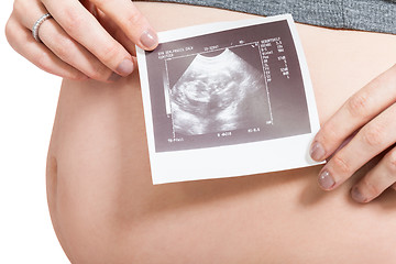 Image showing Pregnant woman displaying a prenatal ultrasound