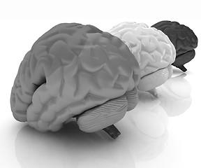 Image showing Human brains