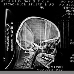 Image showing Glowing and radiant MRI scan