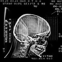 Image showing Glowing and radiant MRI scan