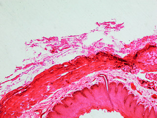 Image showing Epithelium micrograph