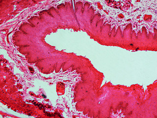 Image showing Epithelium micrograph