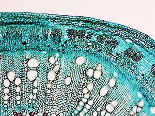 Image showing Cotton stem micrograph