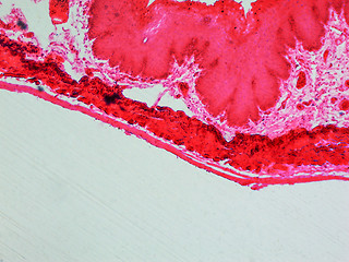 Image showing Epithelium micrograph