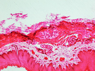 Image showing Epithelium micrograph