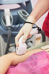 Image showing photo epilation