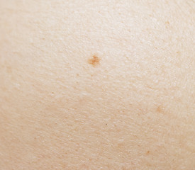 Image showing human skin