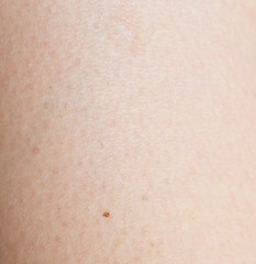 Image showing human skin