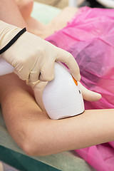 Image showing photo epilation